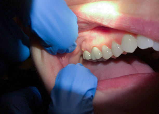 Best Emergency Gum Pain Relief  in Garrett, TX