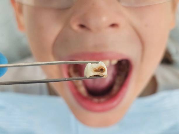 Best Teeth Whitening  in Garrett, TX