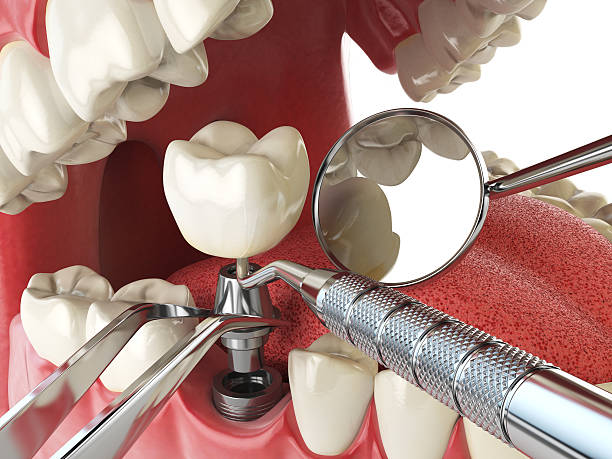 Best Tooth Pain Emergency Relief  in Garrett, TX